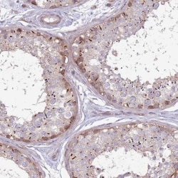 CCDC150 Antibody, Novus Biologicals 25 &mu;L, Unlabeled:Antibodies, Polyclonal